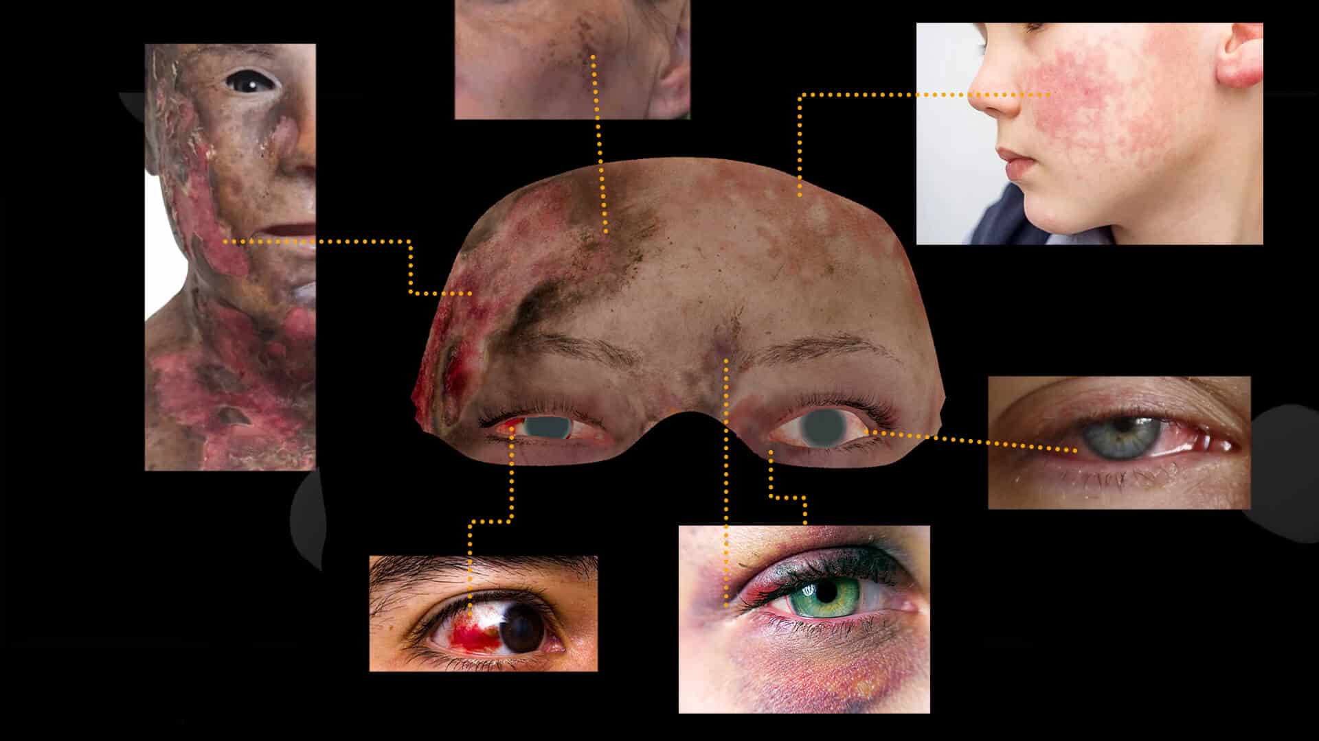 closeup images of various skin conditions on faces and eyes digital production Close-up images of various skin conditions on faces and eyes.